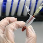 नेपालमा ३४ हजारमध्ये ८ हजार एचआईभी सङ्क्रमित उपचार बाहिर